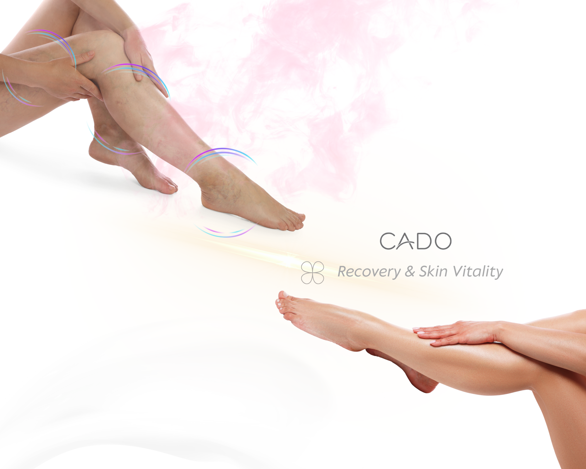 Visible veins and heavy legs